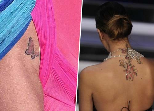 cancellazione tatuaggi corpo